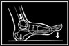 Running Shoe Types